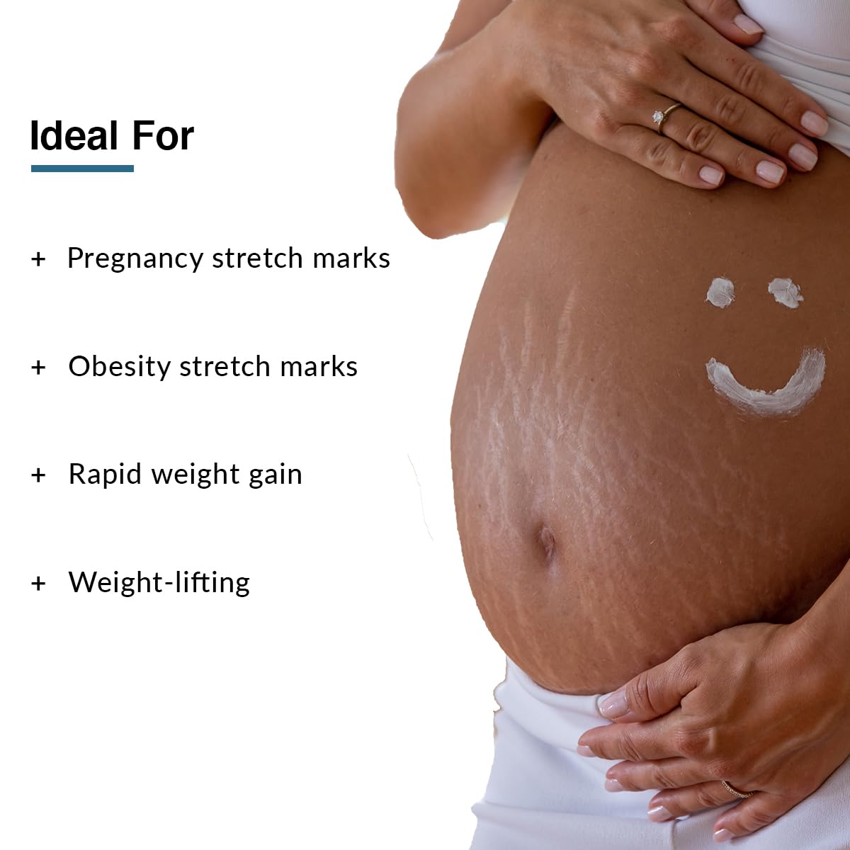 Fixderma Strallium Stretch Mark Cream 150g